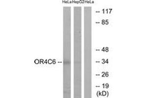 Western Blotting (WB) image for anti-Olfactory Receptor, Family 4, Subfamily C, Member 6 (OR4C6) (AA 193-242) antibody (ABIN2891001)