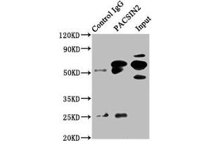 Immunoprecipitating PACSIN2 in HepG2 whole cell lysate Lane 1: Rabbit control IgG instead of ABIN7165686 in HepG2 whole cell lysate. (PACSIN2 antibody  (AA 240-410))