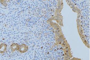 ABIN6275893 at 1/100 staining Human uterus tissue by IHC-P. (CPA1 antibody  (Internal Region))