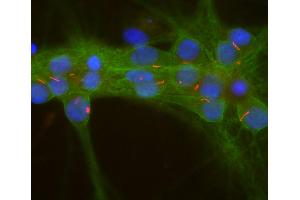 Confocal image of mixed rat neuron-glial cultures stained with our rabbit polyclonal antibody to ACIII (red) and our mouse monoclonal antibody to aII-spectrin (MCA-3D7 green). (ADCY3 antibody  (AA 1125-1144))