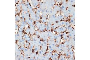 Immunohistochemistry of paraffin-embedded human liver using S100 Rabbit mAb (ABIN7270127) at dilution of 1:100 (40x lens). (S100A6 antibody)