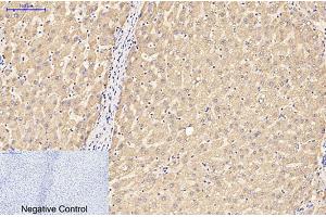 Immunohistochemical analysis of paraffin-embedded human liver tissue. (GFAP antibody)