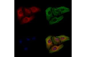 ABIN6255524 and ABIN6267296 staining Hela cells(4h of LPS treatment) by IF/ICC. (HSP27 antibody  (pSer82))