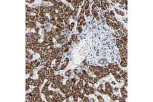 Immunohistochemical staining of human liver with GLT8D1 polyclonal antibody  shows strong granular cytoplasmic positivity in hepatocytes at 1:50-1:200 dilution.
