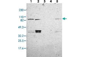 Western blot analysis of Lane 1: RT-4, Lane 2: U-251 MG, Lane 3: Human Plasma, Lane 4: Liver, Lane 5: Tonsil with MAD1L1 polyclonal antibody  at 1:250-1:500 dilution. (MAD1L1 antibody)