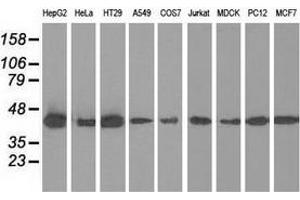 Western blot analysis of extracts (35 µg) from 9 different cell lines by using anti-IVD monoclonal antibody. (IVD antibody)