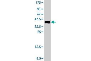 Western Blot detection against Immunogen (37 KDa) . (BLMH antibody  (AA 356-454))