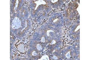 IHC analysis of Hsp47/SERPINH1 using anti-Hsp47/SERPINH1 antibody (ABIN3043331). (SERPINH1 antibody  (AA 247-418))