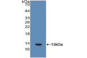 Detection of Recombinant IL6R, Human using Polyclonal Antibody to Interleukin 6 Receptor (IL6R) (IL-6 Receptor antibody  (AA 216-356))
