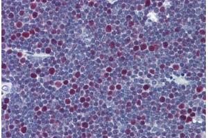 Human Thymus: Formalin-Fixed, Paraffin-Embedded (FFPE) (LIG1 antibody  (AA 810-920))