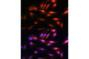 Immunofluorescence analysis of H9C2 cells using COPS8 Rabbit pAb (ABIN6130122, ABIN6138889, ABIN6138890 and ABIN6216486) at dilution of 1:100. (COPS8 antibody  (AA 1-209))