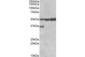 Western Blotting (WB) image for anti-Lymphocyte-Specific Protein 1 (LSP1) (C-Term) antibody (ABIN2464618) (LSP1 antibody  (C-Term))