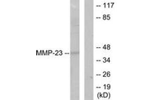 Western blot analysis of extracts from SKOV3 cells, using MMP-23 Antibody. (Matrix Metallopeptidase 23 (MMP23) (AA 341-390) antibody)