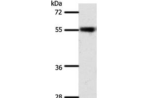 Western Blot analysis of Mouse eye tissue using SLC32A1 Polyclonal Antibody at dilution of 1:500