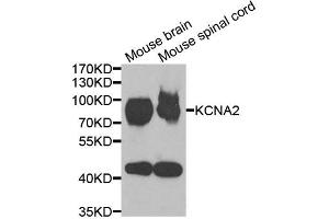 Western blot analysis of extracts of various cell lines, using KCNA2 antibody (ABIN5973718) at 1/1000 dilution. (KCNA2 antibody)