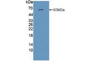 Western blot analysis of recombinant Human GRIN2A. (NMDAR2A antibody  (AA 31-555))