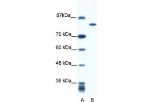Western Blotting (WB) image for anti-Kinesin Family Member 23 (KIF23) antibody (ABIN2460845) (KIF23 antibody)