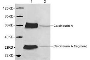 Western blot analysis of mouse brain tissue lysate using 1 µg/mL Rabbit Anti-Calcineurin A Polyclonal Antibody (ABIN398733) Lane 1: Rabbit Anti-Calcineurin A Polyclonal AntibodyLane 2: Rabbit Anti-Calcineurin A Polyclonal Antibody pre-incubated with immunizing peptideThe signal was developed with IRDyeTM 800 Conjugated Goat Anti-Rabbit IgG.