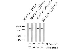 Western blot analysis of Phospho-Myb (Ser532) Antibody expression in mouse lung and mouse spleen tissues lysates. (MYB antibody  (pSer532))