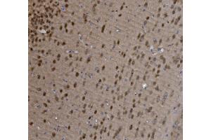 IHC analysis of MEF2C using anti-MEF2C antibody (ABIN6719606). (MEF2C antibody)