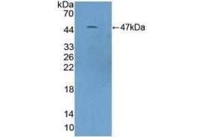 Detection of Recombinant C9, Mouse using Polyclonal Antibody to Complement Component 9 (C9) (C9 antibody  (AA 136-512))