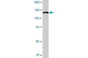 MYLK MaxPab rabbit polyclonal antibody. (MYLK antibody  (AA 1-992))