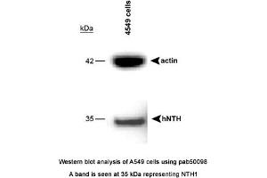 Image no. 1 for anti-Nth Endonuclease III-Like 1 (NTHL1) (full length) antibody (ABIN363407) (Nth Endonuclease III-Like 1 (NTHL1) (full length) antibody)