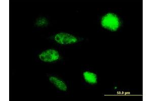 Immunofluorescence of purified MaxPab antibody to TUSC4 on HeLa cell.