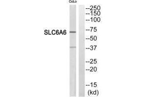 Western blot analysis of extracts from COLO205 cells, using SC6A6 antibody. (TAUT antibody)