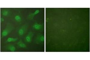 Immunofluorescence analysis of HeLa cells, using CSE1L Antibody. (Exportin 2 antibody  (AA 1-50))