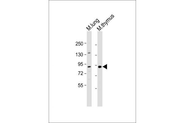 PARP9 Antikörper  (AA 599-629)