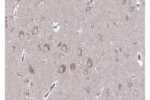 ABIN6268744 at 1/100 staining human brain tissue sections by IHC-P.