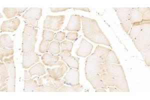 Detection of PADI2 in Human Skeletal muscle Tissue using Polyclonal Antibody to Peptidyl Arginine Deiminase Type II (PADI2) (PADI2 antibody)