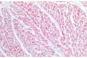 Immunohistochemistry of paraffin-embedded Human heart tissue using BST1 Polyclonal Antibody at dilution of 1:100. (BST1 antibody)