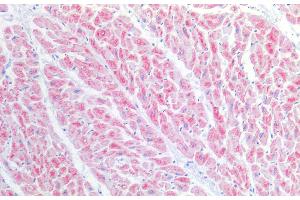 BST1 antibody