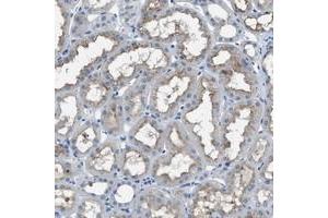Immunohistochemical staining of human kidney with SLC38A6 polyclonal antibody  shows moderate positivity in cytoplasm and membranes. (SLC38A6 antibody)