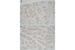 Immunohistochemistry (Formalin/PFA-fixed paraffin-embedded sections) of mouse kidney (A) and mouse epididymis (B) with Usp11 polyclonal antibody . (USP11 antibody)