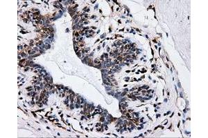 Immunohistochemical staining of paraffin-embedded breast tissue using anti-IFT57 mouse monoclonal antibody.