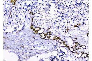 IHC analysis of Caveolin-1/CAV1 using anti-Caveolin-1/CAV1 antibody (ABIN3043803).