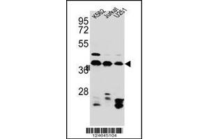 Western blot analysis in Jurkat,K562,U251 cell line lysates (35ug/lane). (HNRNPC antibody  (C-Term))