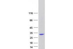 Validation with Western Blot (METTL21C Protein (Myc-DYKDDDDK Tag))