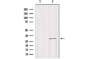 Western blot analysis of extracts from mouse lung, using Galc antibody. (GALC antibody  (Internal Region))