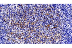 Detection of IL11Ra in Human Lymph node Tissue using Polyclonal Antibody to Interleukin 11 Receptor Alpha (IL11Ra)
