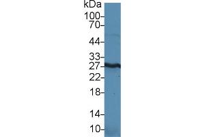 Detection of HMGB1 in Mouse Kidney lysate using Polyclonal Antibody to High Mobility Group Protein 1 (HMGB1) (HMGB1 antibody  (AA 1-215))