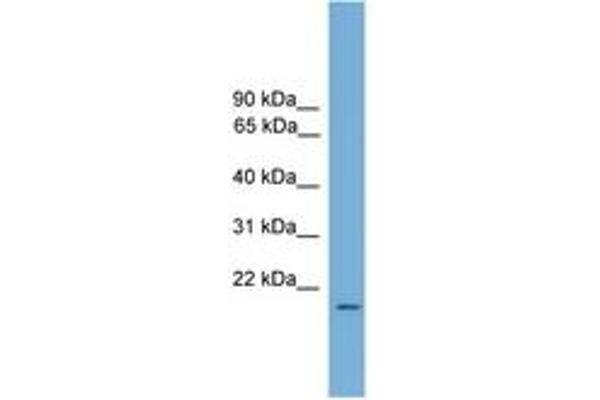 Relaxin 1 antibody  (AA 71-120)