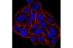 Immunofluorescence (IF) image for anti-DNA (Cytosine-5-)-Methyltransferase 3 beta (DNMT3B) (AA 1-150) antibody (ABIN5542517)