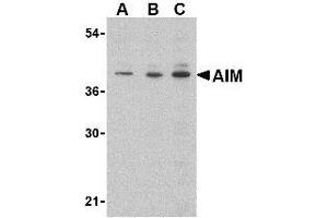Western blot analysis of AIM in Raji lysate with AP30034PU-N AIM antibody at (A) 0. (CD5L antibody  (C-Term))