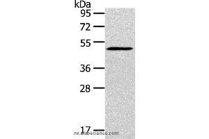 Western blot analysis of Mouse bladder tissue, using SIGLEC15 Polyclonal Antibody at dilution of 1:200 (SIGLEC15 antibody)
