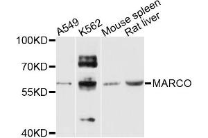 Western blot analysis of extracts of various cells, using MARCO antibody. (MARCO antibody)