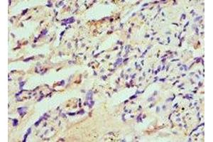 Immunohistochemistry of paraffin-embedded human placenta tissue using ABIN7155937 at dilution of 1:100 (HIP1 antibody  (AA 410-690))